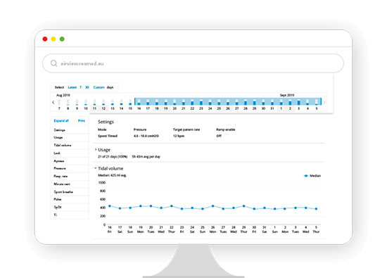 Remote-settings-view-data-ventilation-Airview-telemonitoring-ResMed